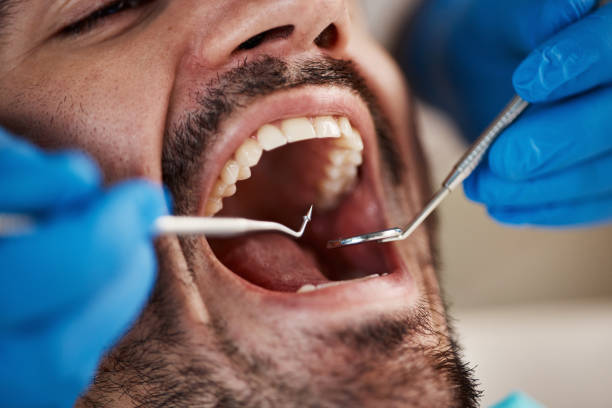 Best Pediatric Emergency Dentist in Artondale, WA